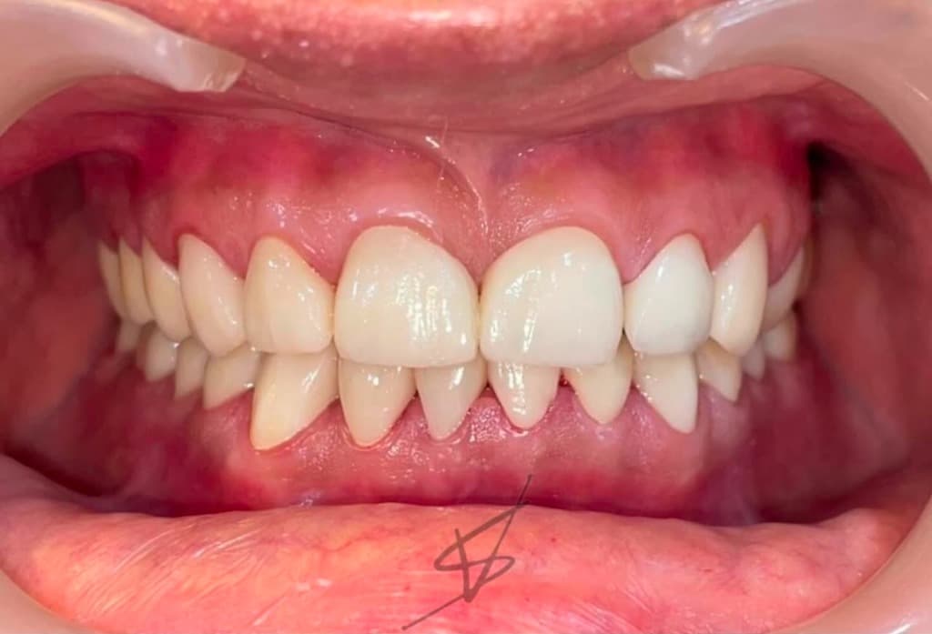 Before dental treatment